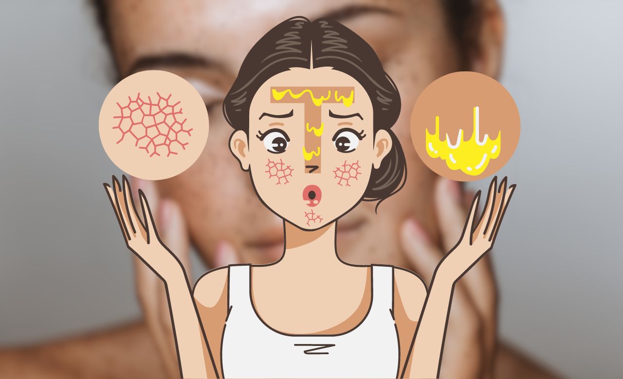 Como Cuidar da Pele Oleosa no Verão Dicas Práticas para Controlar o Excesso de Oleosidade